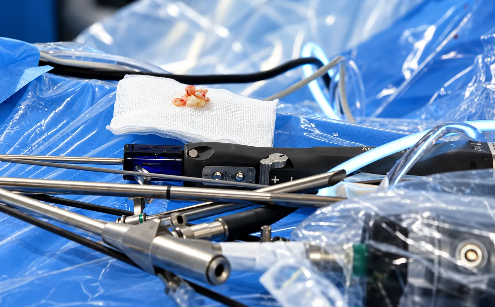 Endoscope et instruments de chirurgie endoscopique du rachis, avec les fragments de hernie discale retirés posés sur une compresse.